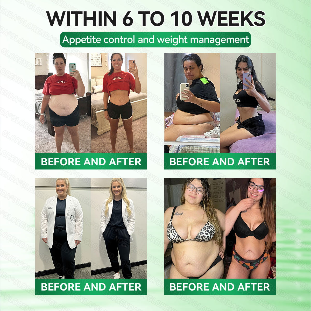 🇺🇸𝟐𝟎𝟐𝟔 𝐍𝐞𝐰 𝐅𝐨𝐫𝐦𝐮𝐥𝐚  | 🍒𝐆𝑳𝑶𝗥𝗘𝗡𝘿𝘼® 𝙈𝒐𝒓𝒊𝒏𝒈𝗮 · 𝗕𝗲𝗿𝗯𝐞𝐫𝐢𝐧𝙚 × 𝙉𝑨𝑫+ 𝟏𝟎-𝙞𝙣-1 𝘼𝒅𝒗𝒂𝒏𝒄𝒆𝐝 𝐍𝐚𝐧𝙤 𝙈𝙞𝙘𝙧𝙤𝙣𝒆𝒆𝒅𝒍𝐞 𝐏𝐚𝐭𝙘𝙝(𝐉𝐮𝐬𝐭 𝐨𝐧𝐜𝐞 𝐚 𝐝𝐚𝐲, 𝐯𝐢𝐬𝐢𝐛𝐥𝐞 𝐜𝐡𝐚𝐧𝐠𝐞𝐬 𝐢𝐧 𝟕 𝑫𝐚𝐲𝐬） ✅ 𝐅𝐨𝐫 𝐎𝐛𝐞𝐬𝐢𝐭𝐲, 𝐀𝐩𝐩𝐞𝐭𝐢𝐭𝐞 𝐂𝐨𝐧𝐭𝐫𝐨𝐥,𝐝𝐢𝐚𝐛𝐞𝐭𝙚𝙨, 𝐬𝐥𝐞𝐞𝐏 𝐚𝐩𝐧𝐞𝐚, 𝐣𝐨𝐢𝐧𝐭 𝐢𝐬𝐬𝐮𝙚𝙨, 𝐚𝐧𝐝 𝐦𝐨𝐫𝐞