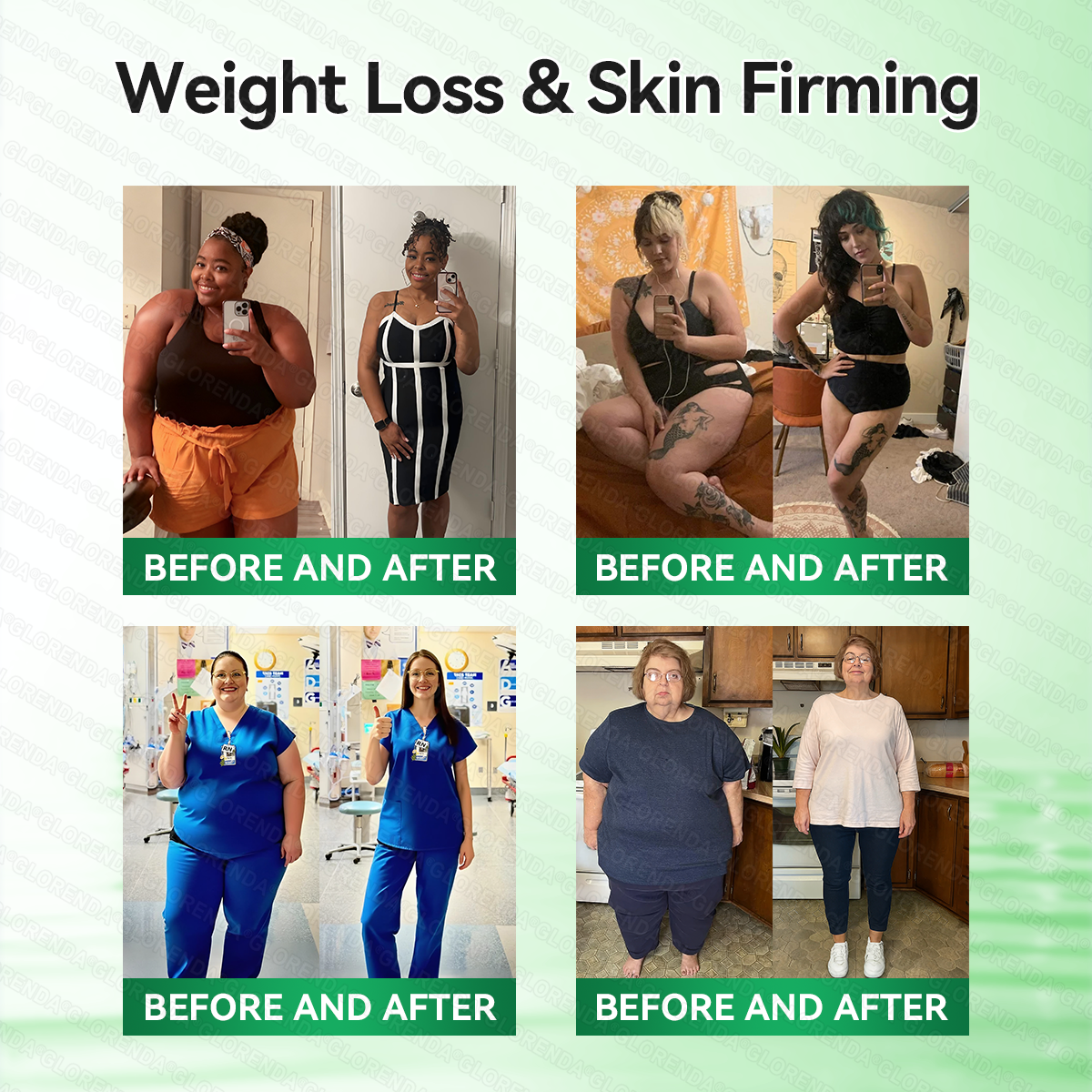 𝑶𝒇𝒇𝒊𝒄𝒊𝒂𝒍 𝑺𝒕𝒐𝒓𝒆  | 👩‍⚕️👩‍⚕️𝐆𝐋𝐎𝑹𝑬𝑵𝑫𝗔®𝑴𝒐𝒓𝒊𝒏𝒈𝗮 · 𝗕𝗲𝗿𝗯𝗲𝗿𝙞𝙣𝙚 × 𝙉𝘼𝐃+ 𝟏𝟎-𝐢𝐧-𝟏 𝗔𝗱𝘃𝗮𝗻𝗰𝙚𝙙 𝙉𝙖𝙣𝙤 𝙈𝙞𝙘𝙧𝙤𝙣𝙚𝙚𝐝𝐥𝐞 𝐏𝐚𝐭𝙘𝙝🇺🇸(𝐉𝐮𝐬𝐭 𝐨𝐧𝐜𝐞 𝐚 𝐝𝐚𝐲, 𝐯𝐢𝐬𝐢𝐛𝐥𝐞 𝐜𝐡𝐚𝐧𝐠𝐞𝐬 𝐢𝐧 𝟕 𝐝𝐚𝐲𝐬） ✅ 𝐅𝐨𝐫 𝐨𝐛𝐞𝐬𝐢𝐭𝐲, 🅛🅞🅞🅢🅔 🅢🅚🅘🅝,𝐝𝐢𝐚𝐛𝐞𝐭𝐞𝐬, 𝐬𝐥𝐞𝐞𝐩 𝐚𝐩𝐧𝐞𝐚, 𝐣𝐨𝐢𝐧𝐭 𝐢𝐬𝐬𝐮𝐞𝐬, 𝐚𝐧𝐝 𝐦𝐨𝐫𝐞